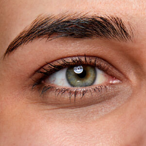 Dark Circles