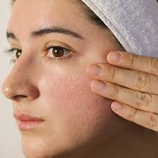 Large Pores